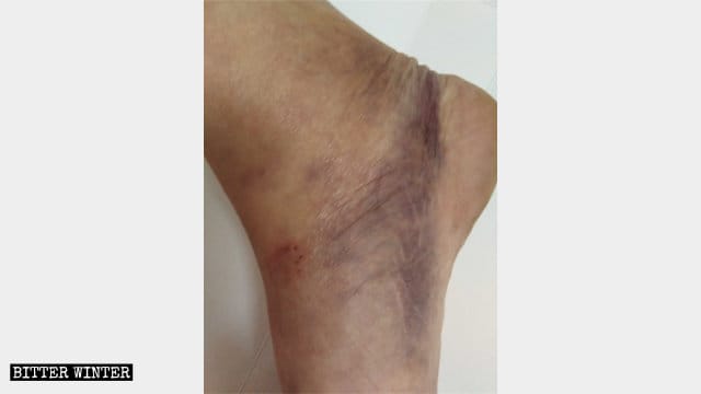 Wei-Lihuis verletzter Fuß